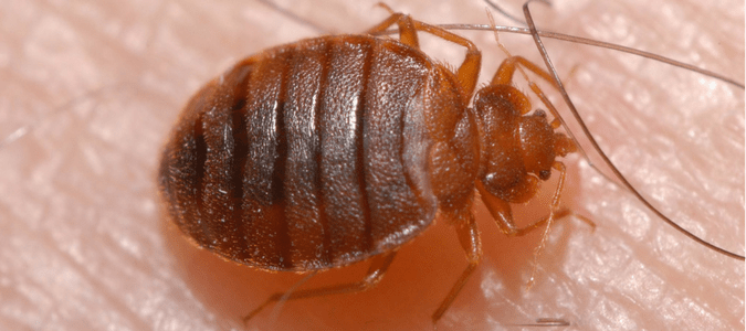 bed bug bites on scalp pictures